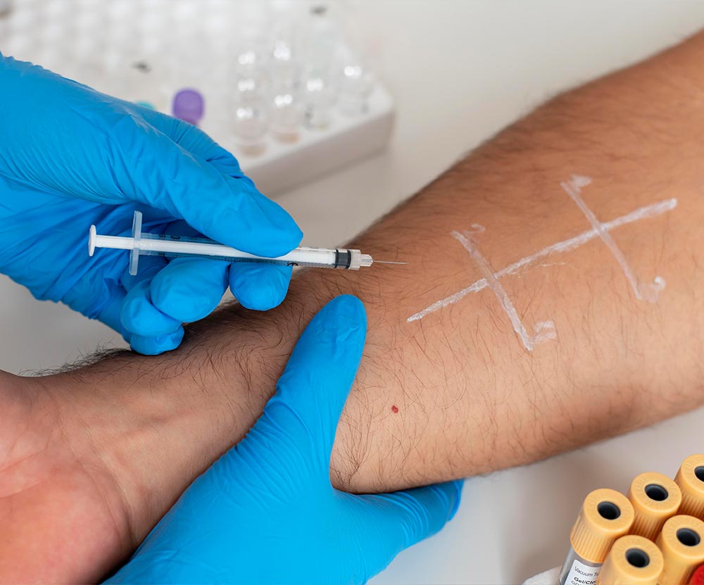 Vein-Removal-Home